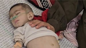 سكان غزة يعانون من عملية تجويع وحشية على يد الاحتلال- إكس