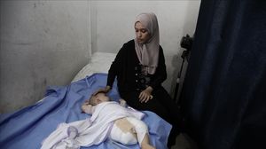 غارة إسرائيلية تُخمد ضحكة الرضيع هاني وتحولها إلى ألم ومعاناة دائمة- الأناضول