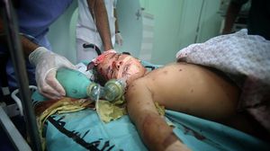 طفلة جريحة جراء القصف الإسرائيلي في غزة - الأناضول