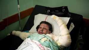 سقوط 230 شهيدا وآلاف الجرحى في العدوان الأخير على غزة - الأناضول 