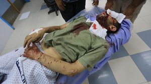 جريح جراء القصف الإسرائيلي على غزة - (وكالات محلية)