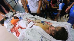 أصيب 3150 فلسطينيا، بحسب مصادر طبية فلسطينية - الأناضول
