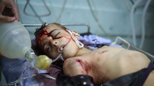 200 شهيد من أطفال غزة حتى الآن جراء العدوان الإسرائيلي - الأناضول