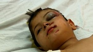 نسبة كبيرة من ضحايا العدوان الإسرائيلي على غزة من الأطفال - أرشيفية 