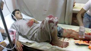 فتى يتلقى العلاج بعد إصابته في القصف في سرمين الجمعة