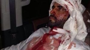 إصابة عضو المكتب السياسي في حزب الأمة عبد الهادي الهاجري - (وكالات محلية)