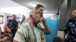 جريح فلسطين جراء القصف الإسرائيلي على غزة - الأناضول