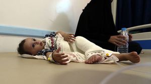 طفل مصاب بالكوليرا مع والدته في أحد المستشفيات اليمنية- أ ف ب
