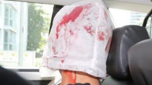 نشرت صحيفة "بيلد" الألمانية صورة قالت إنها لمهاجم هامبورغ وعلى وجهه غطاء ملطخ بالدماء- بيلد