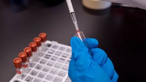 تعمل شركة ألمانية على تطوير اللقاح المحتمل لفيروس كورونا المستجد- CC0