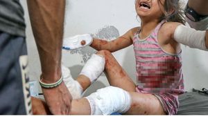 الأطفال ضحايا قصف النظام وحلفائه في إدلب- الأناضول