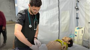 نشرت مستشفى الكويت صورا للشاب أبو الحصين يظهر فيها أشبه بهيكل عظمي- فيسبوك