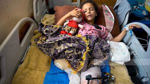 غارة إسرائيلية تحوّل أفراد عائلة فلسطينية إلى أصحاب إعاقة دائمة.. و"سيلا" رمز الألم المستمر - وكالة وفا 