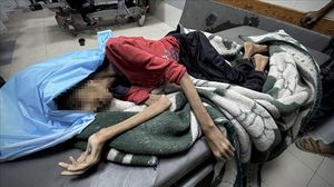 بدأت أزمة المجاعة في قطاع غزة تتفاقم بشكل كارثي مع فرض الحصار الإسرائيلي المشدد منذ مارس 2025، في تصعيد لسياسة التجويع التي ترتكبها إسرائيل منذ بداية الحرب في أكتوبر 2023.. الأناضول