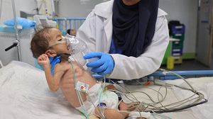 حالات وفاة متلاحقة في غزة بسبب الجوع والأرقام في ارتفاع - جيتي