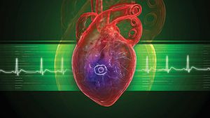 يتم زرع الأجهزة التقليدية لتنظيم ضربات القلب بأعلى الصدر من خلال فتحة تتصل بالقلب - تعبيرية