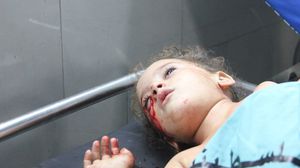 طفلة مصابة بشظايا الصواريخ الإسرائيلية - شهاب