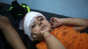 إصابات خطيرة بسبب الصواريخ الإسرائيلية التي تستهدف المدنيين والأطفال - الأناضول