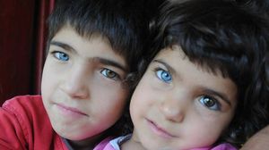 أليف وياسين إحدى عينيهما زرقاء والأخرى بُنية اللون - الأناضول