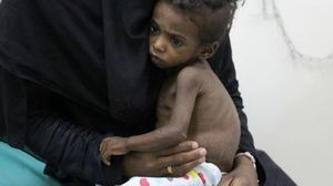 يعاني اليمن من انهيار شبه تام في القطاع الصحي تحت وطأة حرب مستمرة منذ أكثر من خمسة أعوام- جيتي