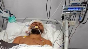 اضطر الطاقم الطبي لإجراء عملية جراحية معقدة في رأس محمد عطوي- النهار / تويتر