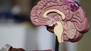 وجود الحديد والنحاس في الدماغ ليس أمرا متوقعا بحسب باحثين- CC0