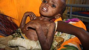 طفلة تعاني من سوء التغذية في مقديشو - أ ف ب