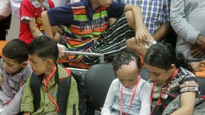 أطفال مصابون من ضحايا القصف الإسرائيلي على غزة - الأناضول