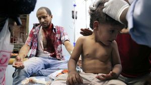 العفو الدولية: كل أطراف الصراع في اليمن ترتكب انتهاكات بحق المدنيين ـ أ ف ب 