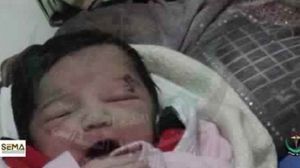 الطفلة أمل ولدت مصابة بشظية بسبب قصف قوات بشار - لوموند الفرنسية