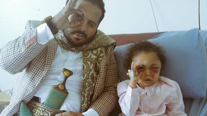 الطفلة بثينة الناجية الوحيدة من أسرتها التي قصفها الطيران السعودي- تويتر