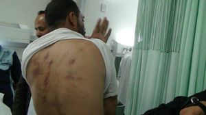 معتقل تعرض للتعذيب على يد جماعة الحوثي- تويتر