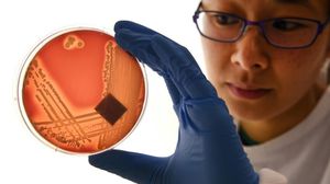 تستطيع البكتيريا الجديدة مقاومة المضادات الحيوية - أ ف ب