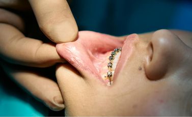 pexels-cottonbro-7584486