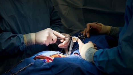 نجاح زراعة كلية خنزير معدلة وراثيًا في الصين.. أمل جديد ...