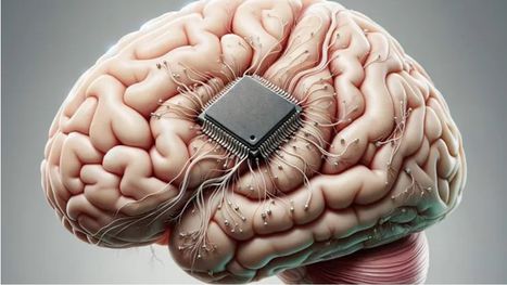 الصين تتقدم في سباق الشرائح الدماغية بزرع "بيناو 1" ...