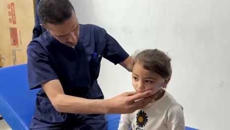 رغم التحديات.. أقنعة ثلاثية الأبعاد تُعيد الأمل لأطفال شوهتهم الحروق في غزة