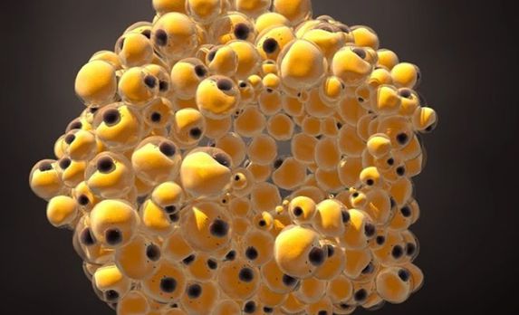 خلايا سرطانية - جيتي