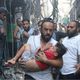 مصابين بقصف الاحتلال في غزة- الأناضول