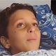 طفل فلسطيني يناشد لعلاجه في مصر بدل بتر رجله