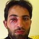 محمد الخطيب - صحفي ناشط إعلامي سوري - تعرض للضرب على يد حرس الحدود التركي خلال عبور الحدود 6-12-2015