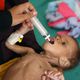 طفل يمني يتلقى العلاج في تعز- جيتي