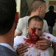 اصابة فلسطيني بعينه من قبل قوات الاحتلال في الضفة الغربية - أ ف ب
