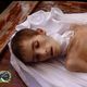 طفل توفي بسبب الجوع والحصار - المعضمية - الغوطة - ريف دمشق - سوريا