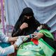 طفل يمني يشتبه بإصابته بالكوليرا - جيتي
