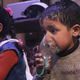 اطفال دوم الكيماوي - الدفاع المدني السوري