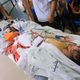 إصابات قصف غزة