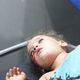 طفلة مصابة بشظايا الصواريخ الإسرائيلية - شهاب