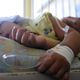 طفل مصاب بحمى الضنك في احد مستشفيات هندوراس في الثالث من اذار/مارس 2014