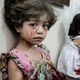 أطفال ضحايا قصف النظام السوري على الغوطة - الأناضول